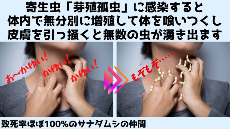 致死率ほぼ100%、皮膚から湧き出す「最凶の寄生虫」の全ゲノムを解読