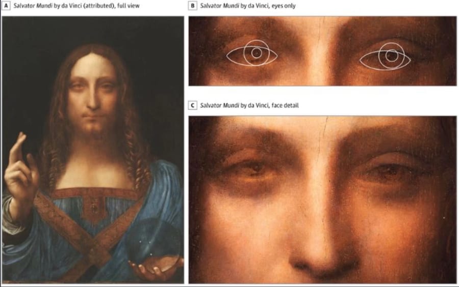 ダ・ヴィンチの天才的な絵の才能は「斜視」が一因だった?