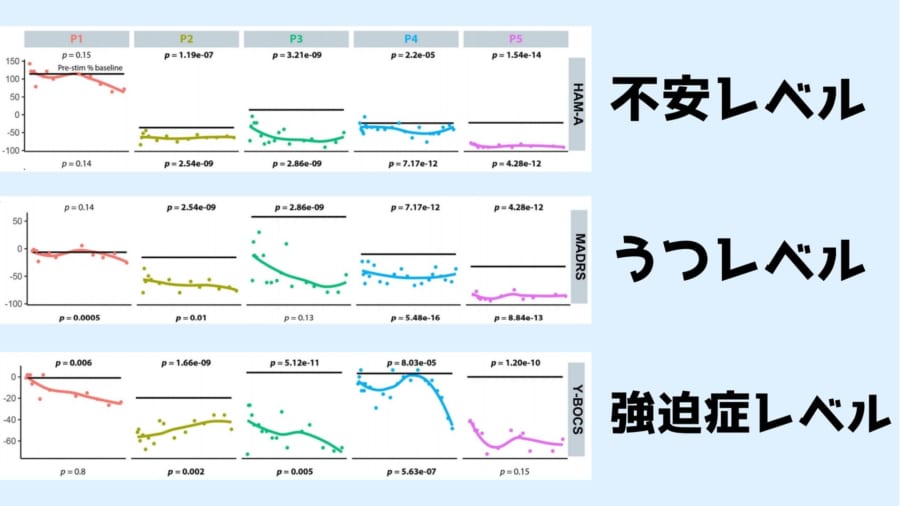 「患者が起きたまま脳に電極を刺し」強迫性障害を治療することに成功