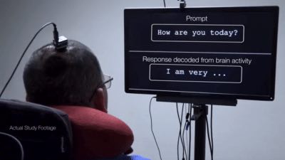頭の中での発音を「文章にして話せる」脳インプラントが開発される