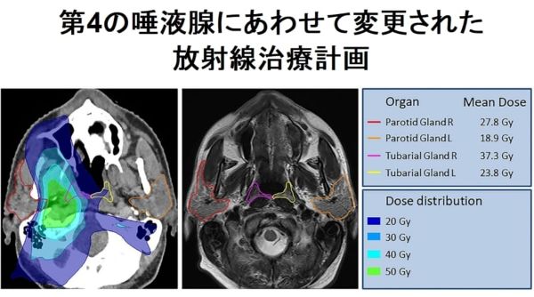 4.人間のノドから「未知の臓器」が発見される!全人類が隠し持っていた