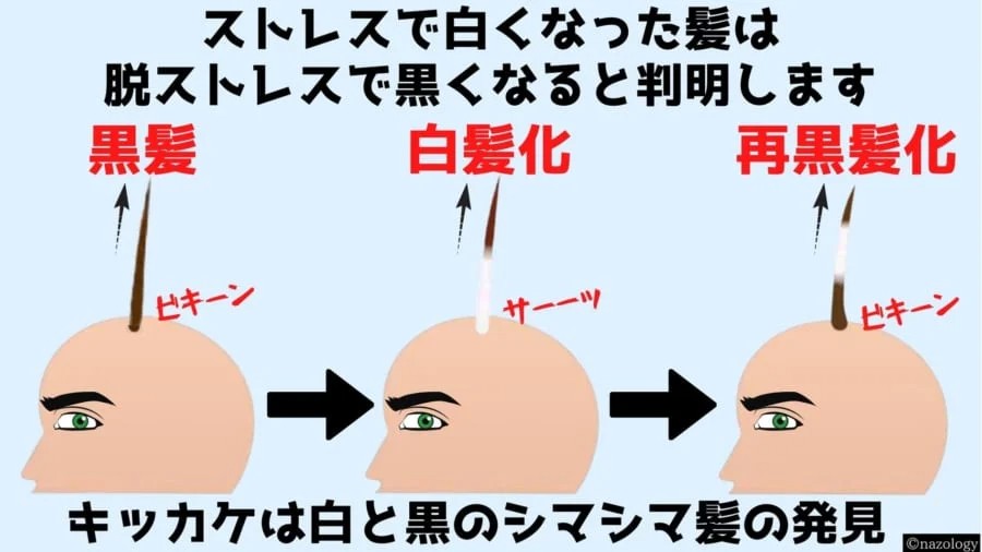 脱ストレスで「白髪は元に戻る」と明らかに