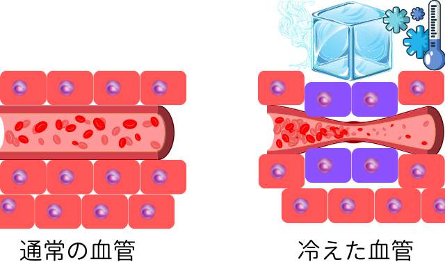 冷たいはずのドライアイスで「やけど」するのはなぜか?
