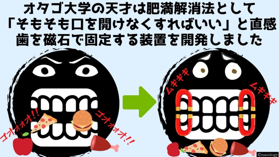 磁石で口を「物理的にロック」する減量装置が開発される