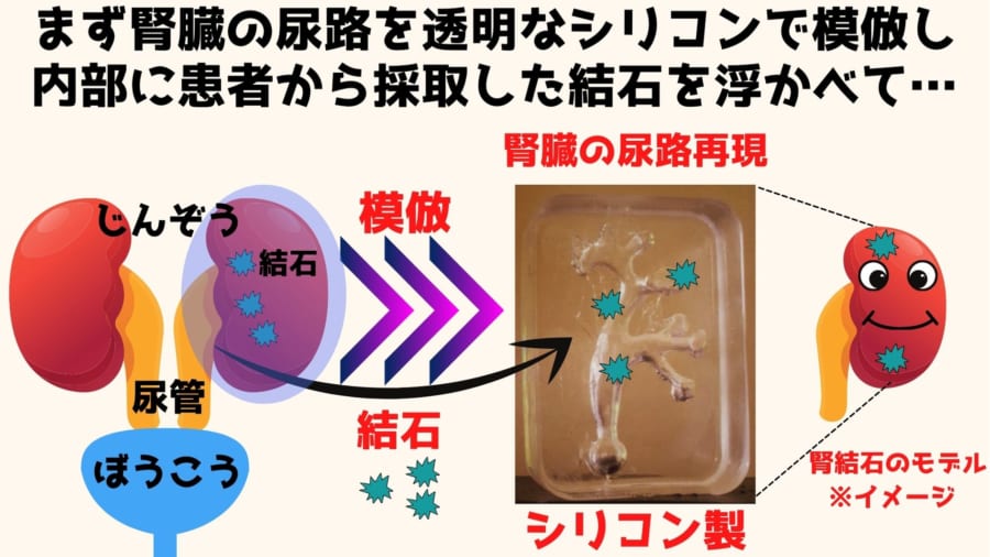 ビッグサンダーマウンテンに腎臓結石を排出させる効果があるという研究